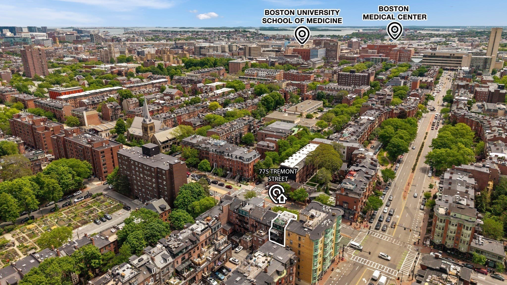 5+ Family - 5+ Units Up/Down at 775 Tremont Street, Boston MA 02118, Boston, photo 4 of 24